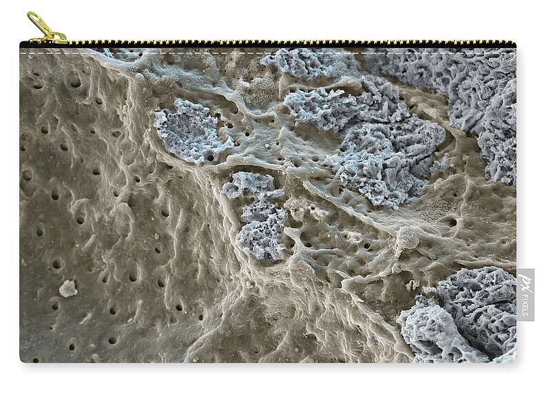 Color Zip Pouch featuring the photograph Dentin & Tooth Enamel, Sem by Meckes/ottawa