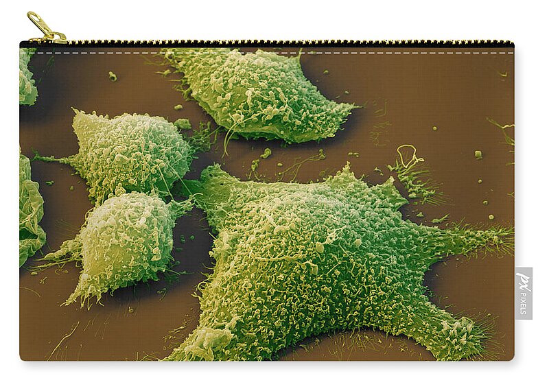Cancer Zip Pouch featuring the photograph Intestinal Cancer Cells by Meckes/ottawa