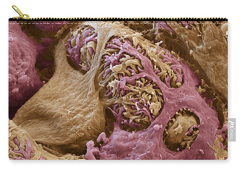 Blood Zip Pouch featuring the photograph Renal Corpuscle, Sem by Meckes/ottawa