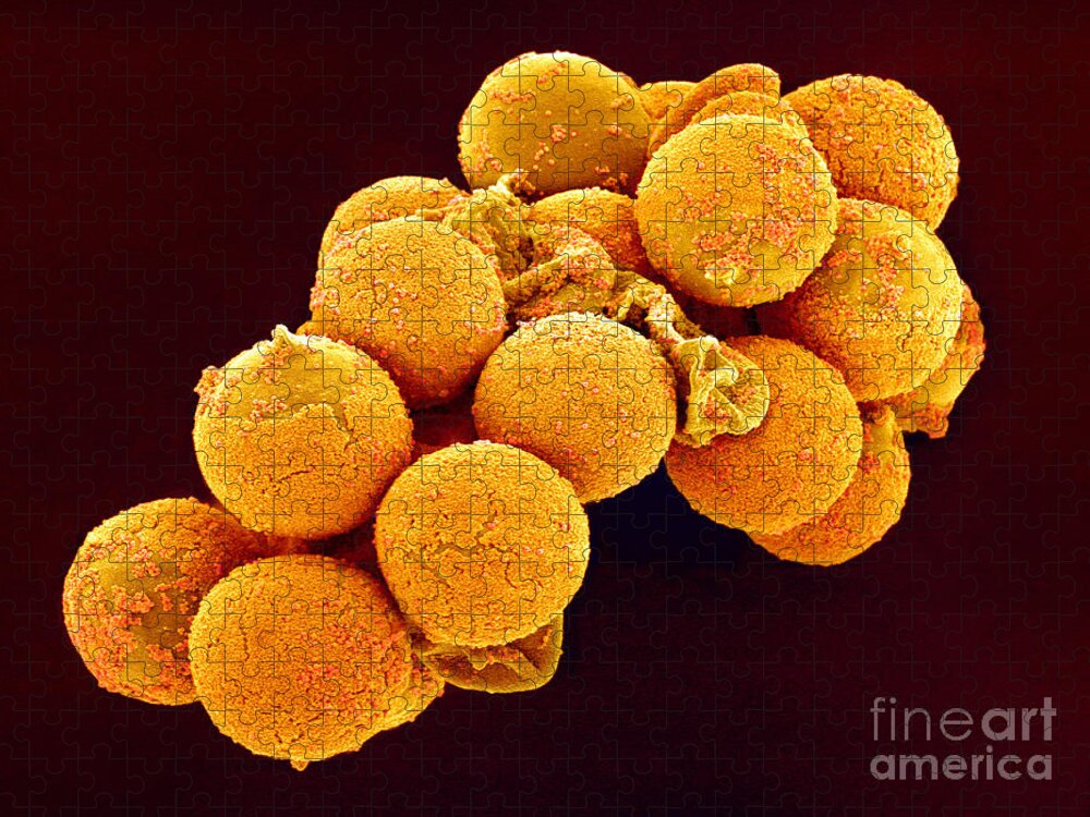 Allergen Jigsaw Puzzle featuring the photograph Cedar Pollen, Sem #2 by Susumu Nishinaga