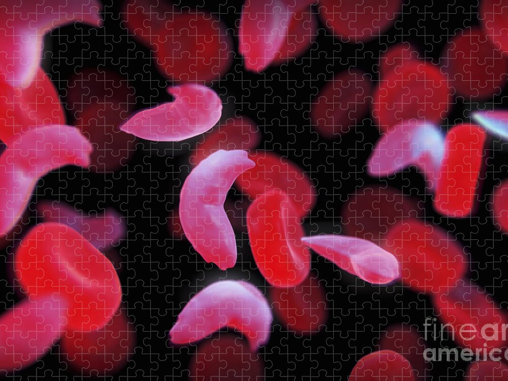 Cell Jigsaw Puzzle featuring the photograph Sickle-cell Disease #4 by Science Picture Co