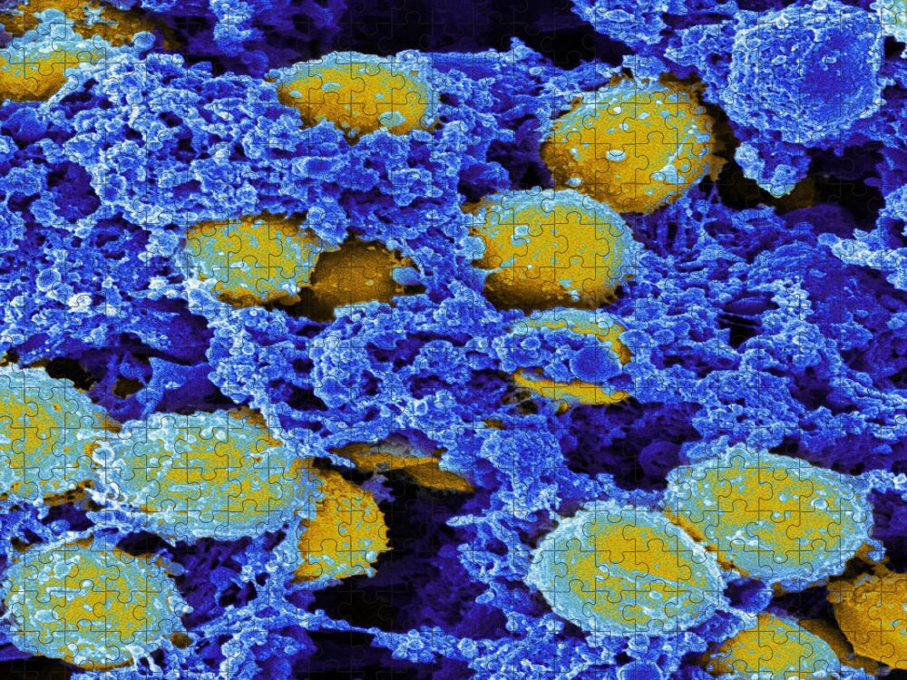 Staphylococcus Aureus Jigsaw Puzzle featuring the photograph Staphylococcus Aureus Bacteria Sem #5 by Science Source