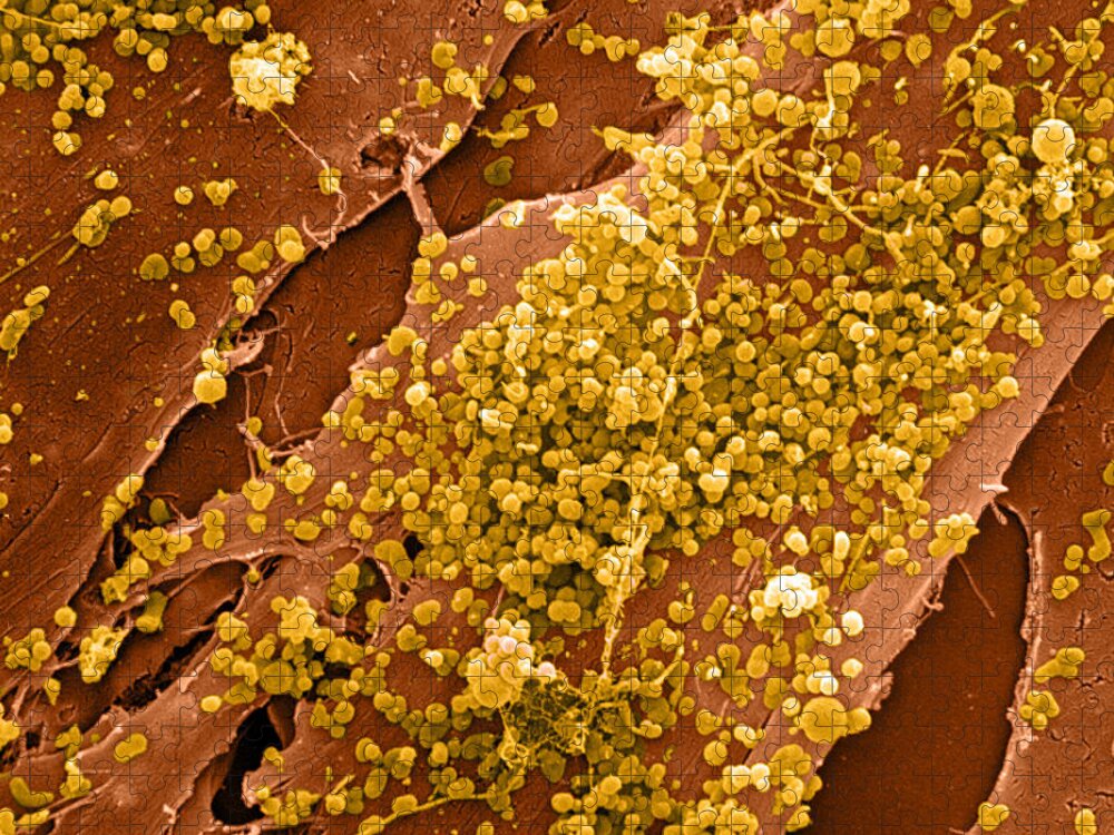 Cell Jigsaw Puzzle featuring the photograph Human Skin Cell Sem by David M. Phillips