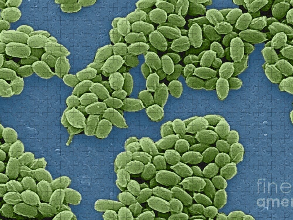 Science Jigsaw Puzzle featuring the photograph Anthrax Bacteria Sem #9 by Science Source