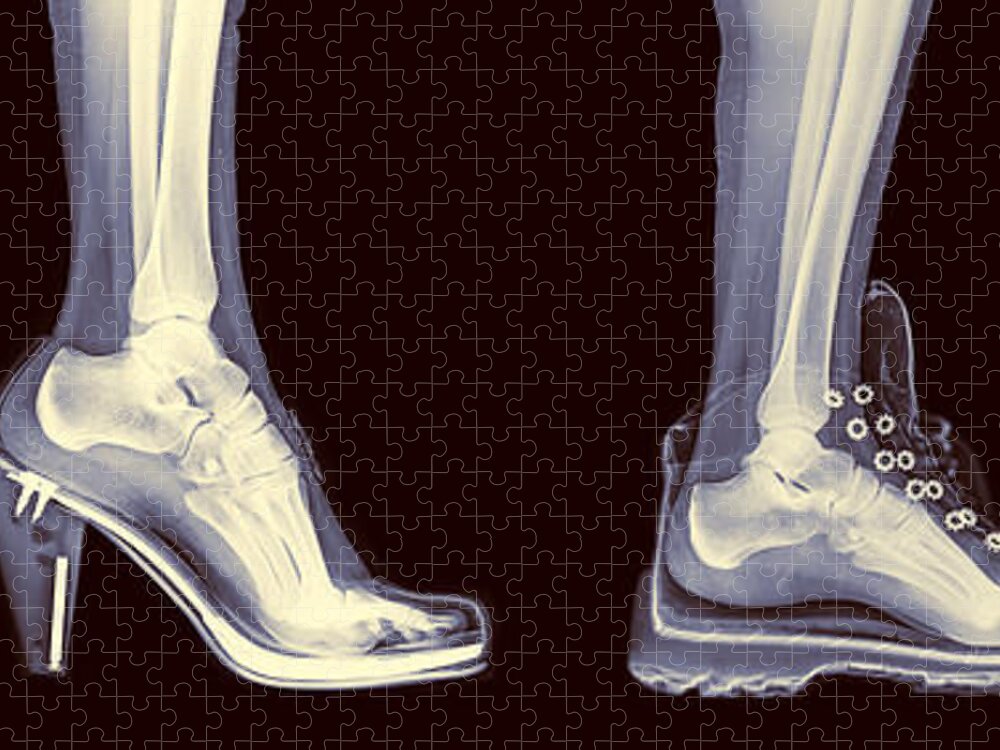 Ankle Jigsaw Puzzle featuring the photograph Different Shoes X-ray by Guy Viner