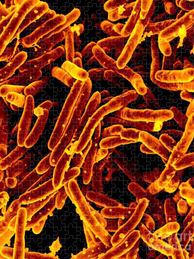Microbiology Jigsaw Puzzle featuring the photograph Mycobacterium Tuberculosis Bacteria, Sem #1 by Science Source