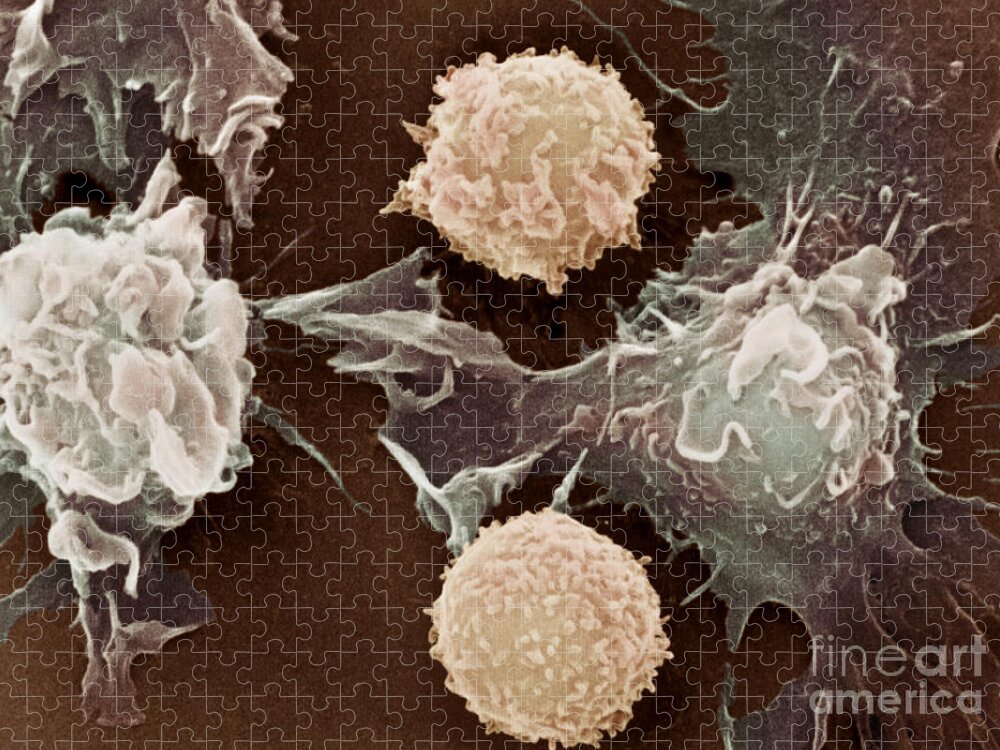 Cancer Jigsaw Puzzle featuring the photograph Cancer Cells #5 by Science Source