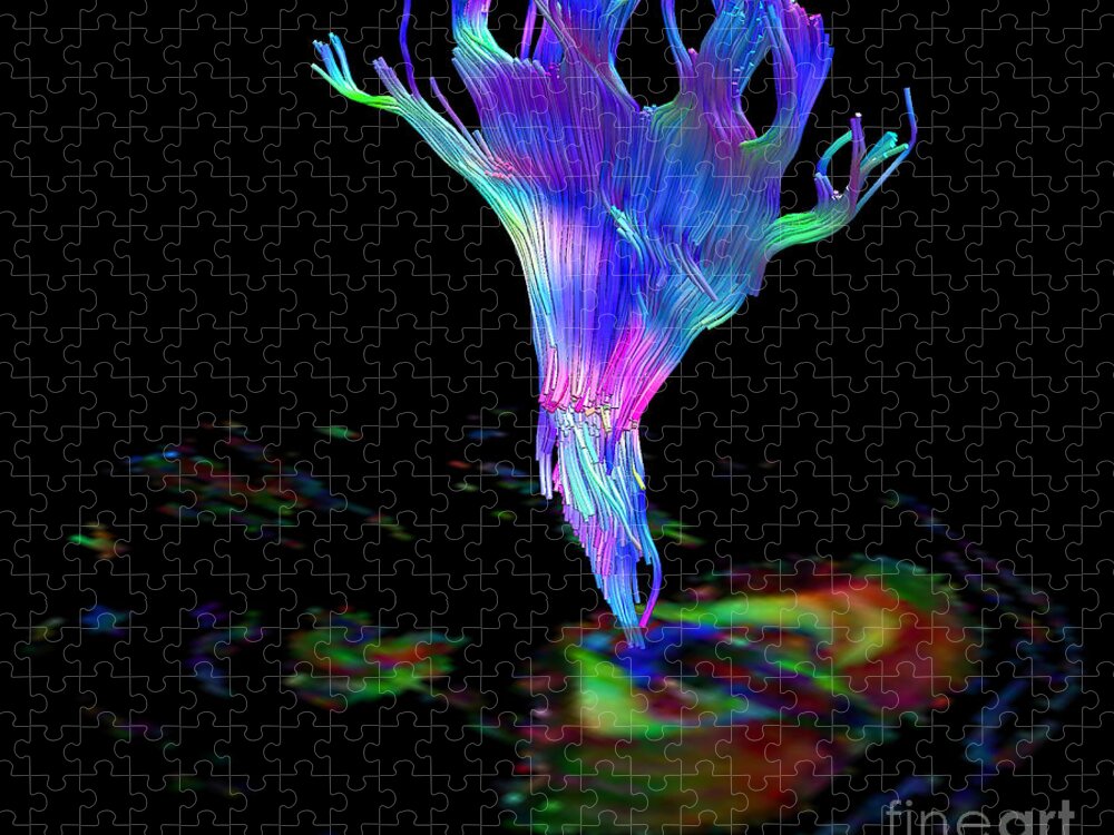 Brain Mri Jigsaw Puzzle featuring the photograph Corona Radiata, Diffuse Tensor Imaging #1 by Living Art Enterprises