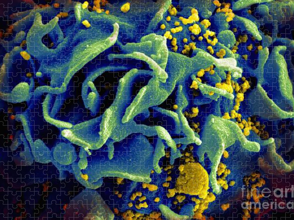 Microbiology Jigsaw Puzzle featuring the photograph Hiv-infected T Cell, Sem by Science Source