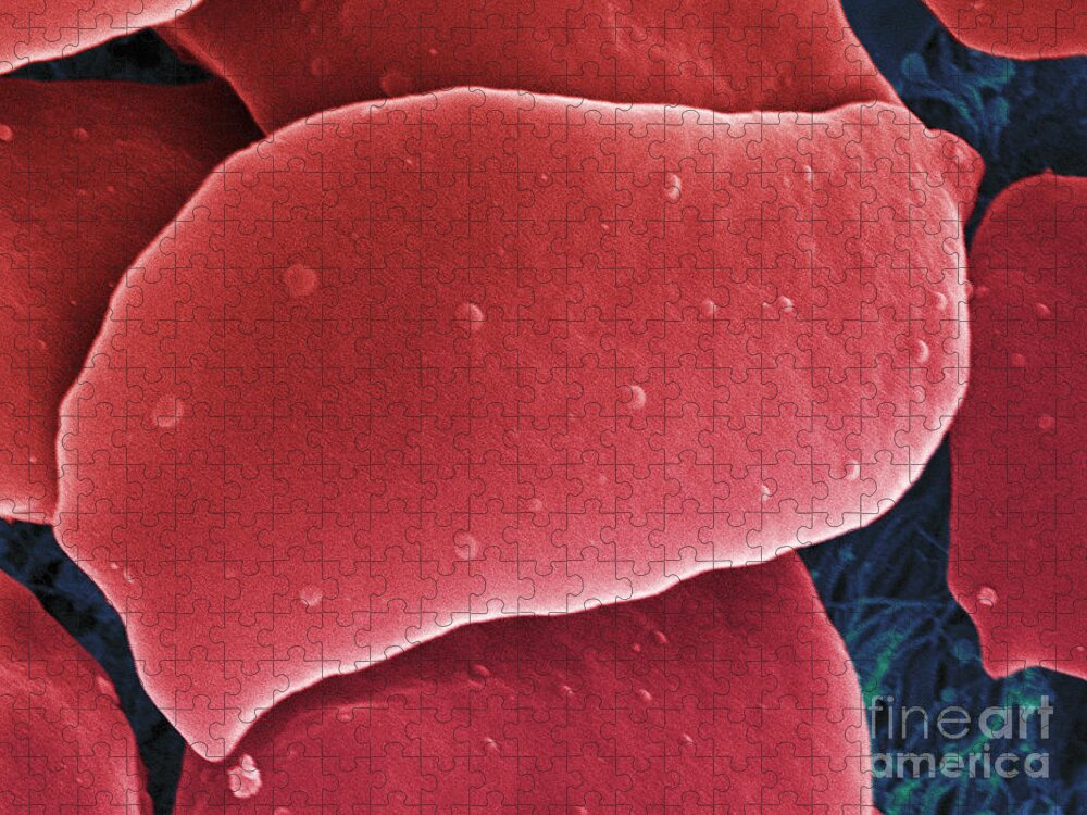 Science Jigsaw Puzzle featuring the photograph Blood Platelets, Sem #2 by Ted Kinsman