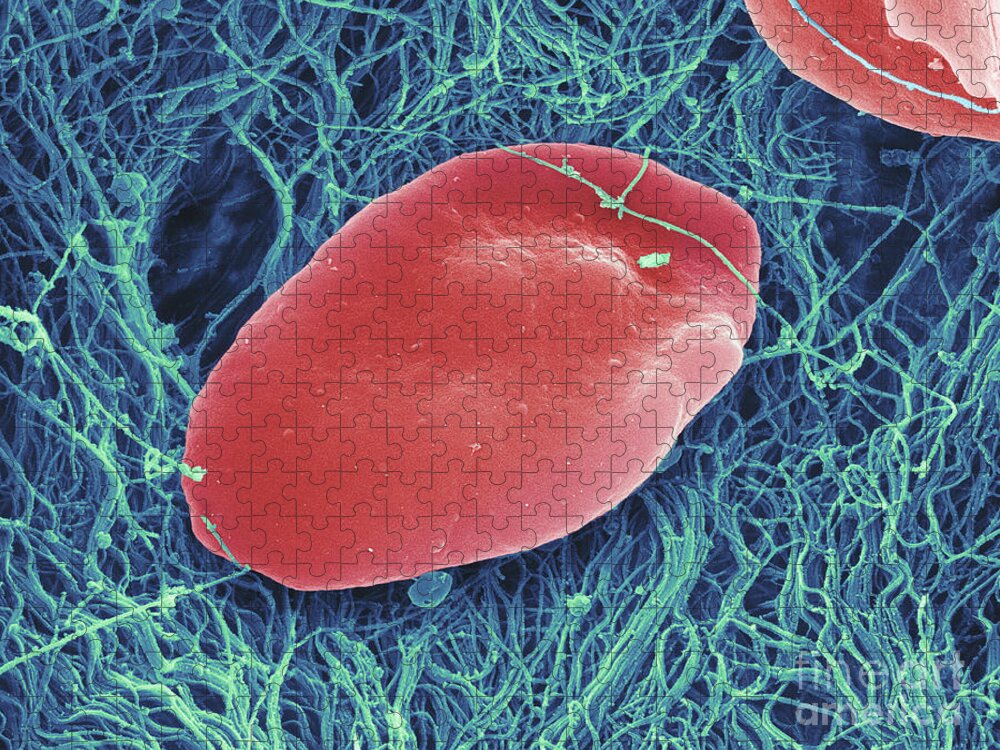 Science Jigsaw Puzzle featuring the photograph Blood Platelets, Sem #3 by Ted Kinsman