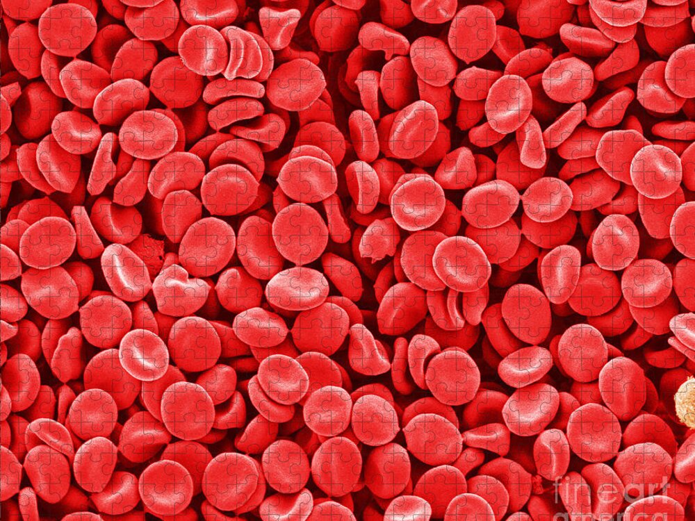 Red Blood Cells Jigsaw Puzzle featuring the photograph Red Blood Cells, Sem #4 by Scimat