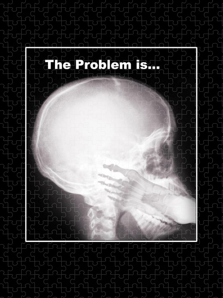 X-ray Jigsaw Puzzle featuring the photograph I See the Problem by Gravityx9 Designs