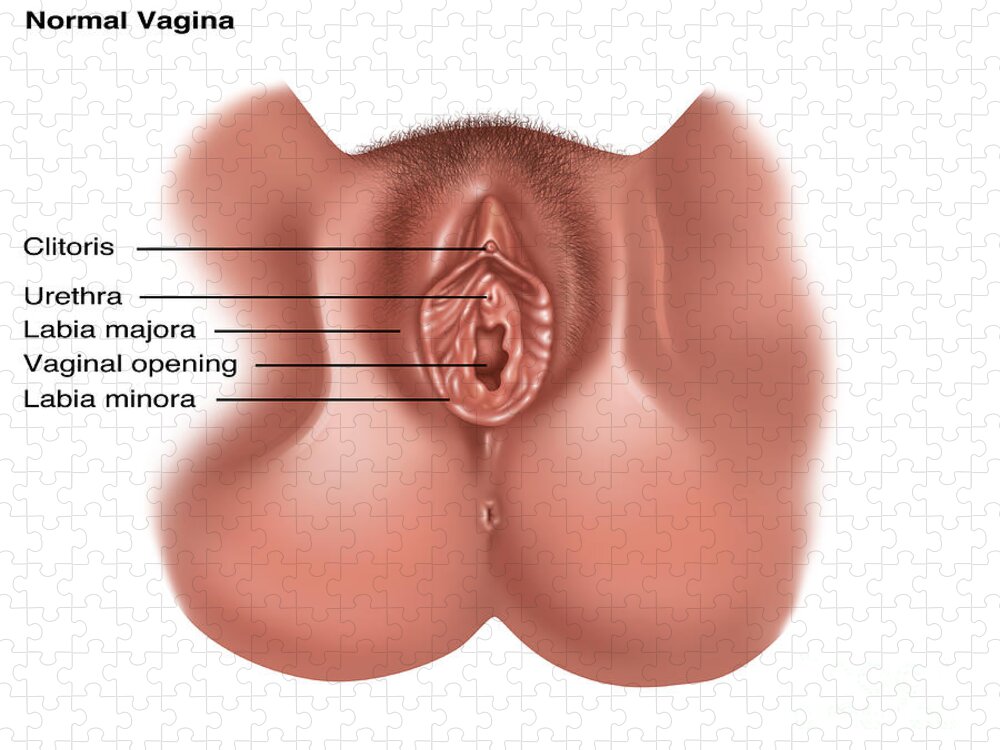 Von vaginas