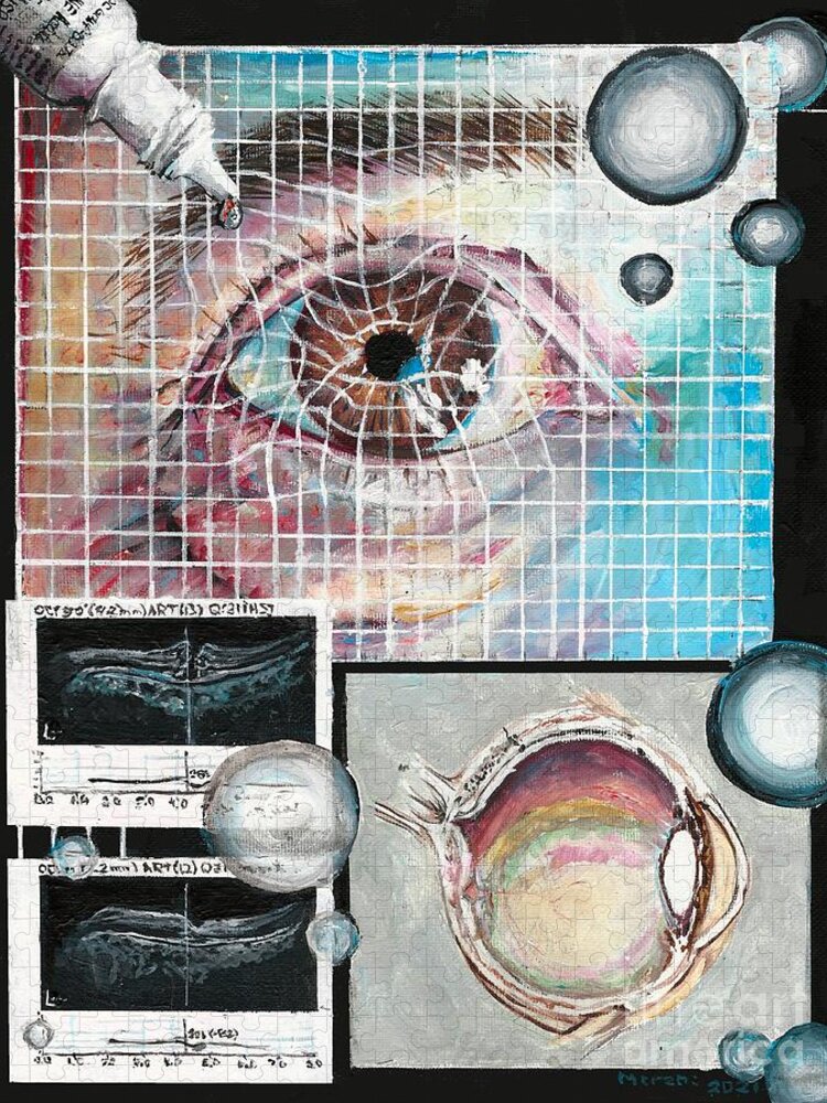 Eye Jigsaw Puzzle featuring the painting Macular Hole Repair by Merana Cadorette