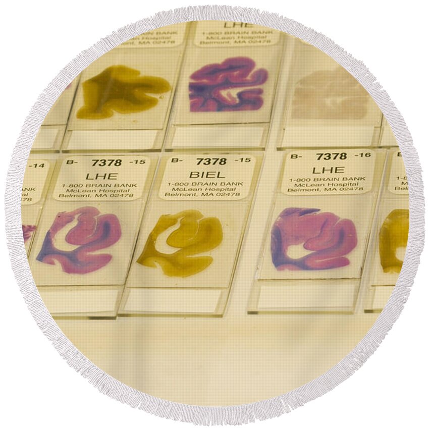 Stained Round Beach Towel featuring the photograph Stained Specimens, Diagnosing Brain #3 by Science Stock Photography