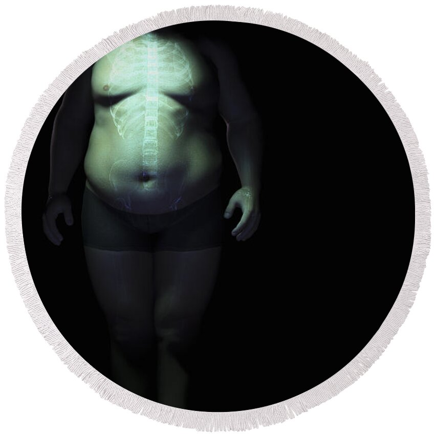 Transparency Round Beach Towel featuring the photograph Obesity #5 by Science Picture Co