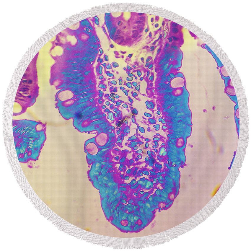 Histology Round Beach Towel featuring the photograph Cryptosporidium In Intestine Of Baby by Dr. Cecil H. Fox