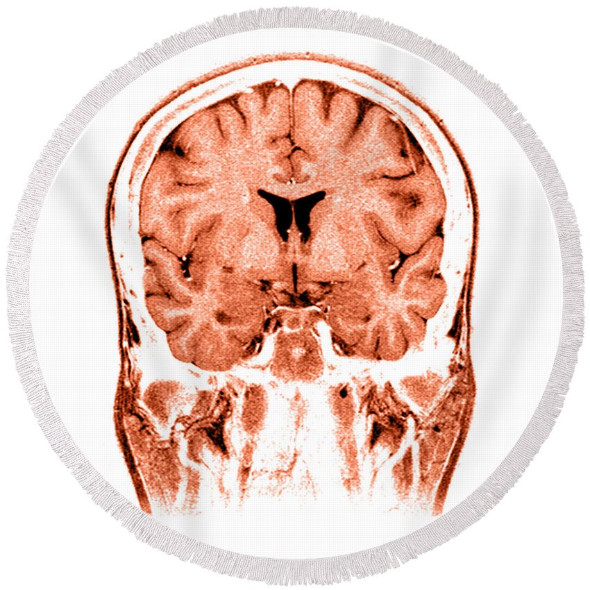 Normal Round Beach Towel featuring the photograph Normal Coronal Mri Of The Brain #1 by Medical Body Scans