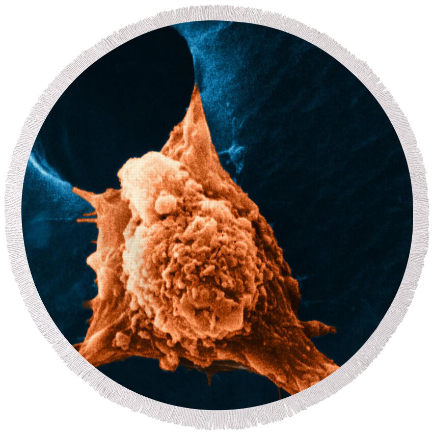 Sem Round Beach Towel featuring the photograph Metastasis #3 by Science Source