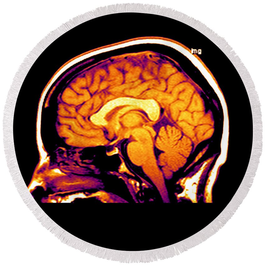 Brain Round Beach Towel featuring the photograph Mri Of Brain #3 by Medical Body Scans