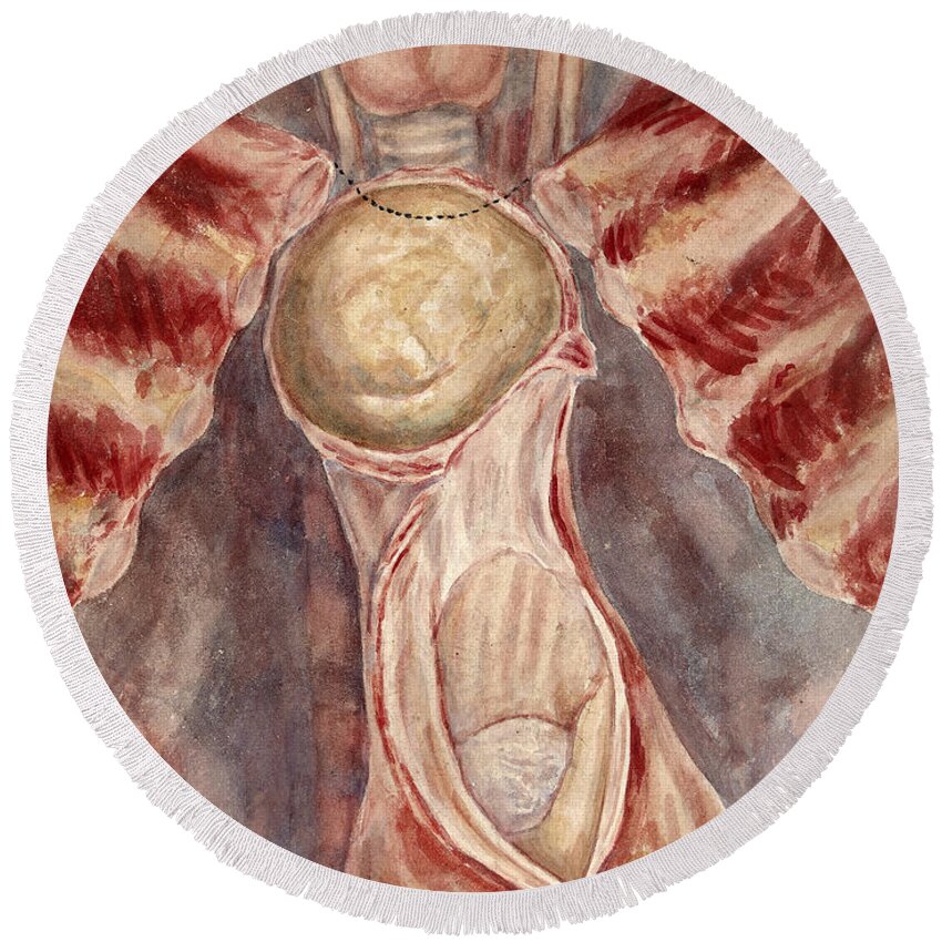 Historic Round Beach Towel featuring the photograph Aneurysm, Aortic Arch, Illustration by Wellcome Images