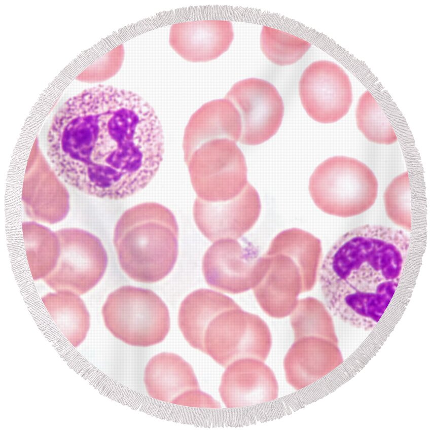Neutrophil Polymorphs Round Beach Towel featuring the photograph Neutrophils In Peripheral Blood Smear by M. I. Walker