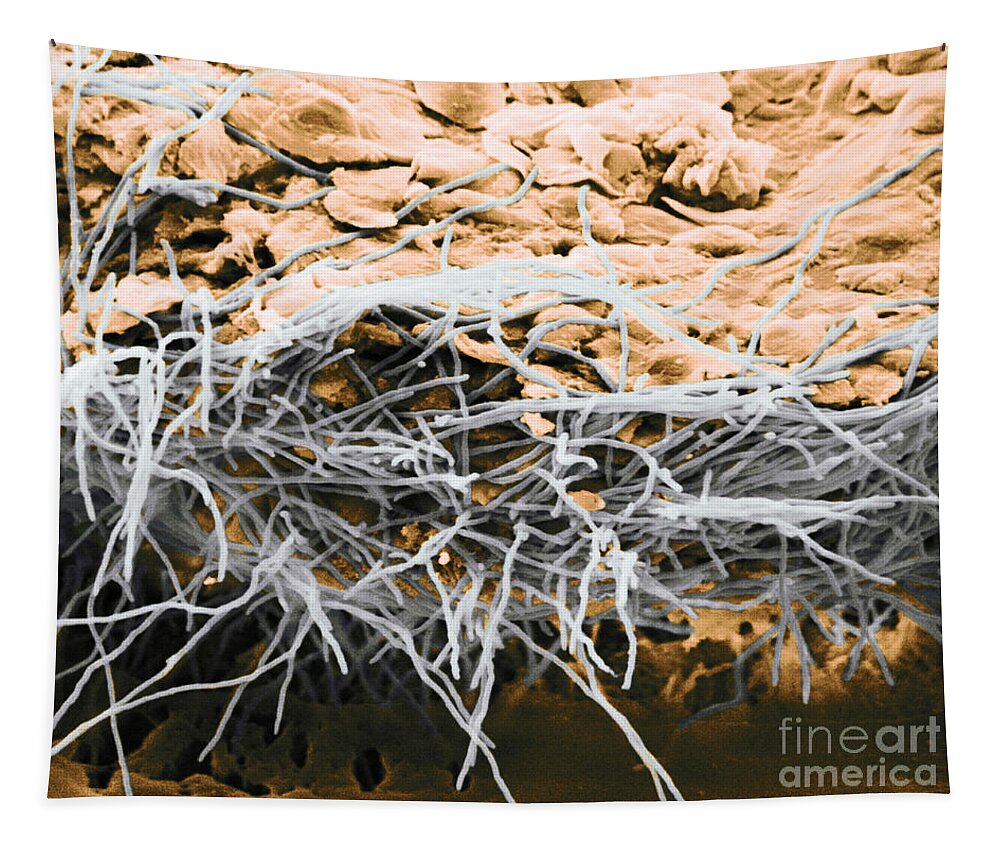 Scanning Electron Micrograph Tapestry featuring the photograph Hyphae On Human Skin, Sem #1 by Biophoto Associates