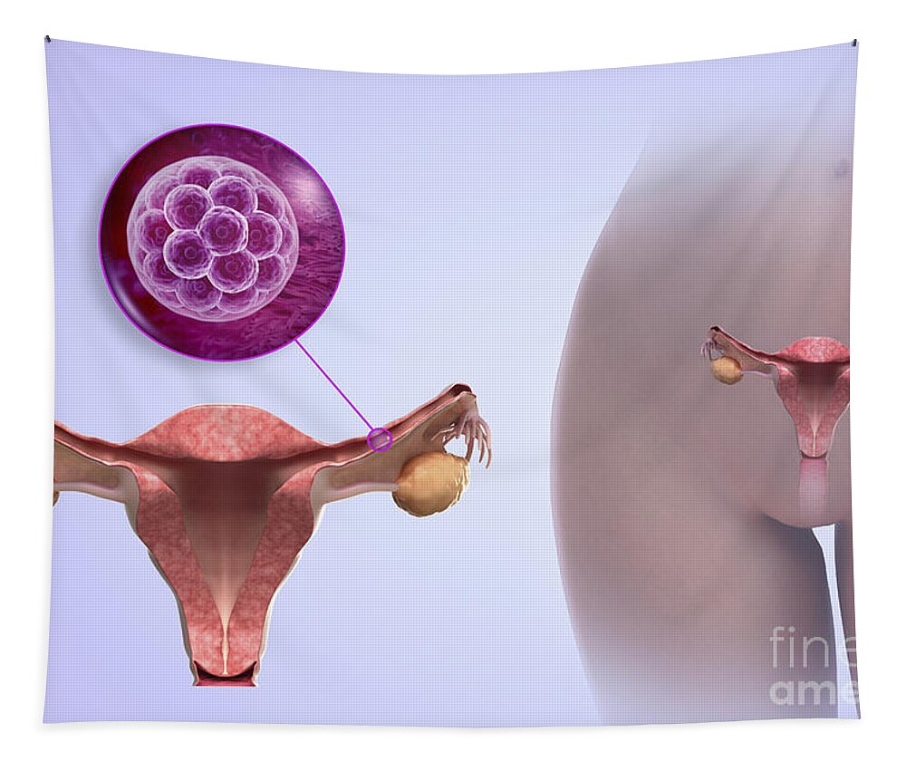 Embryogenesis Tapestry featuring the photograph Morula In Fallopian Tube #1 by Science Picture Co