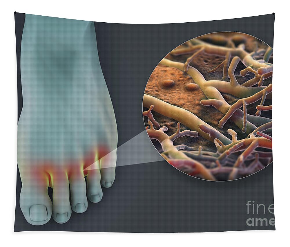 Anatomical Model Tapestry featuring the photograph Athletes Foot #4 by Science Picture Co