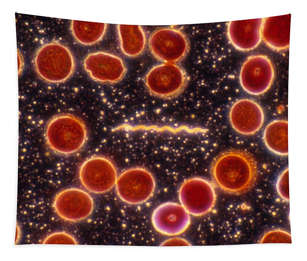Bacteria Tapestry featuring the photograph Borrelia Burgdorferi, Lm by Michael Abbey