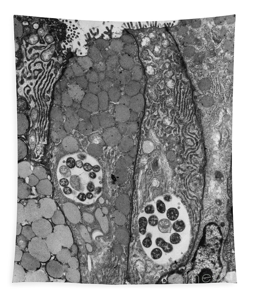 Science Tapestry featuring the photograph Chlamydia Infection, Tem #5 by David M. Phillips