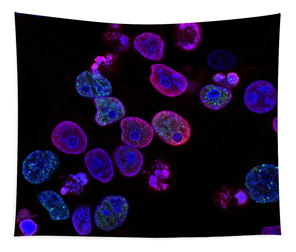 Science Tapestry featuring the photograph Colorectal Cancer Cells Damaged By Atr by Science Source