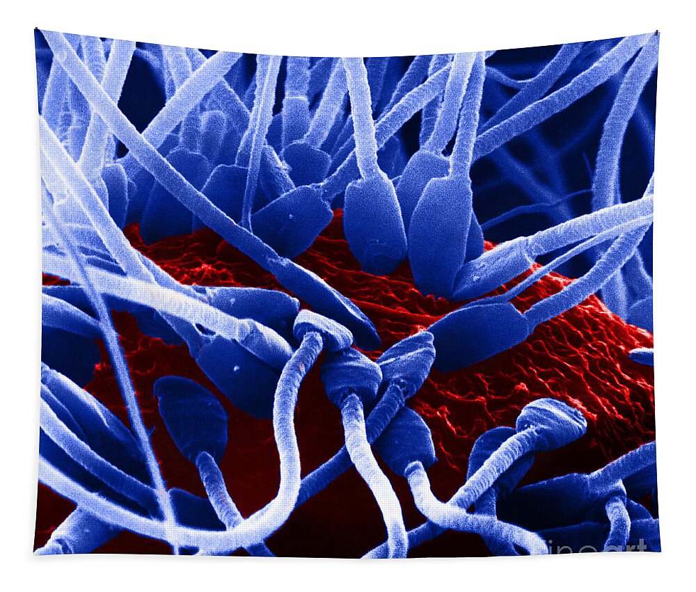 Medical Tapestry featuring the photograph Fertilization In Rat Sem by David M. Phillips