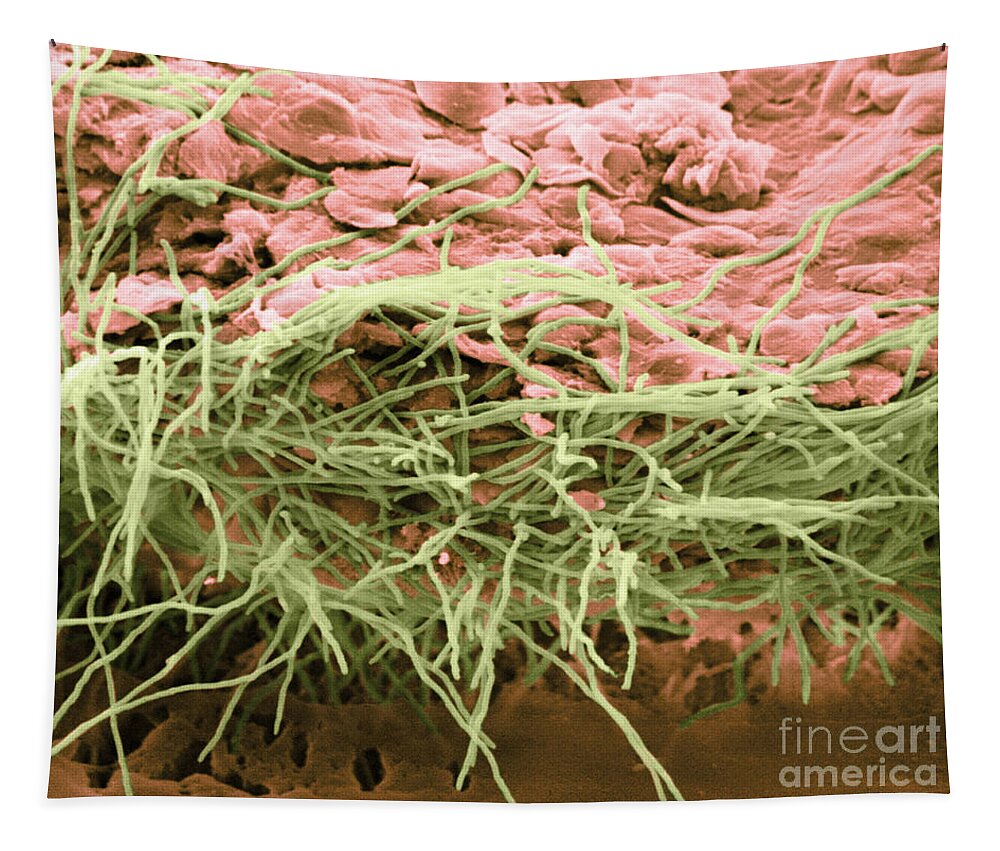 Scanning Electron Micrograph Tapestry featuring the photograph Hyphae On Human Skin, Sem by Biophoto Associates