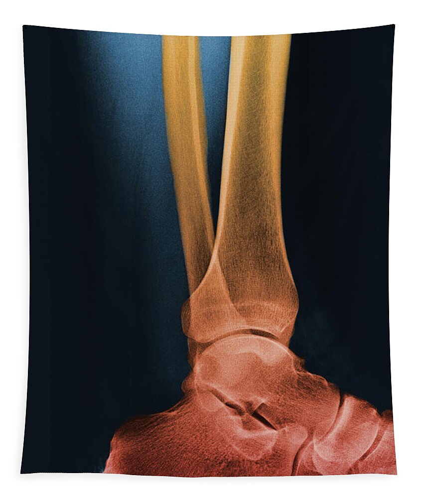 Anatomy Tapestry featuring the photograph Foot X-ray #1 by Ted Kinsman