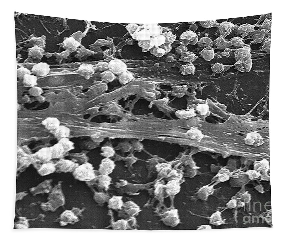 Science Tapestry featuring the photograph Staphylococcus Aureus Bacteria, Sem #2 by Science Source