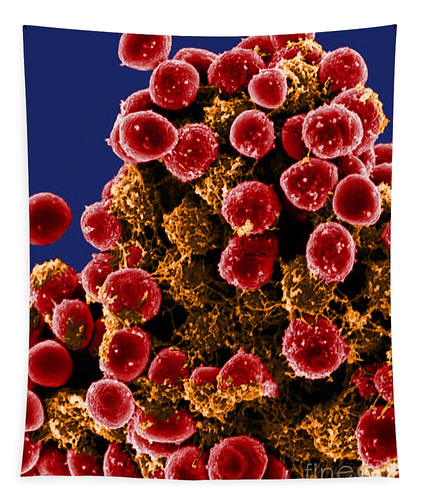 Microbiology Tapestry featuring the photograph Staphylococcus Epidermidis Bacteria, Sem #2 by Science Source