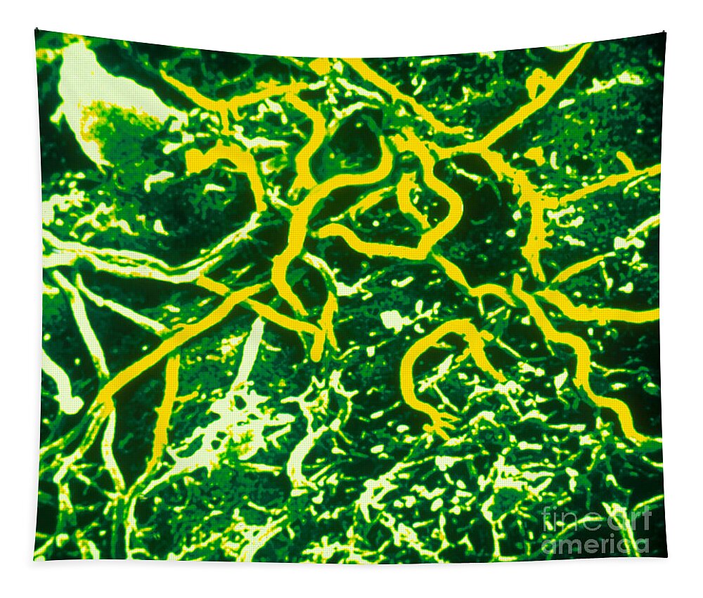 Tem Tapestry featuring the photograph Borrelia Burgdorferi #4 by Science Source
