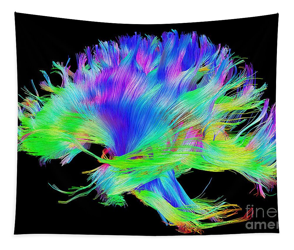 Brain Mri Tapestry featuring the photograph Fiber Tracts Of The Brain, Dti by Living Art Enterprises
