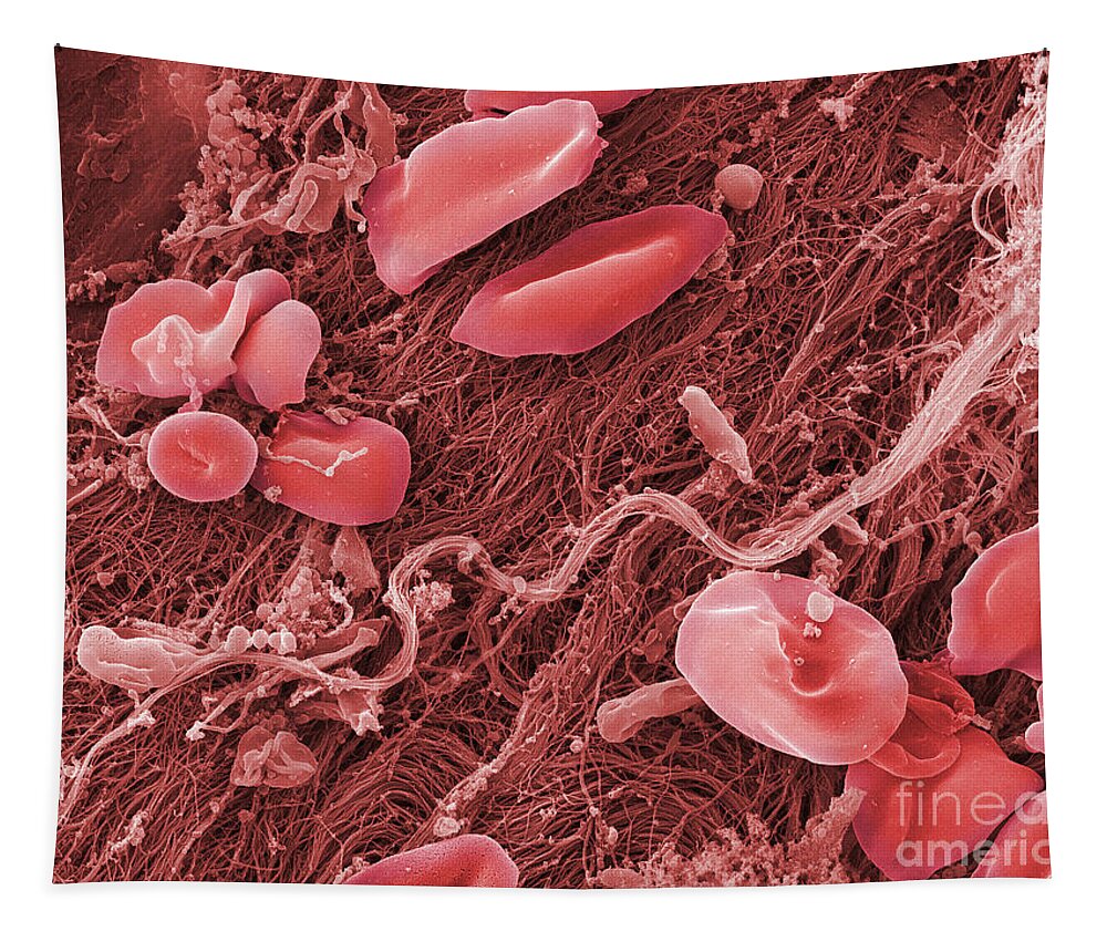Science Tapestry featuring the photograph Blood Platelets And Red Blood Cell, Sem by Ted Kinsman