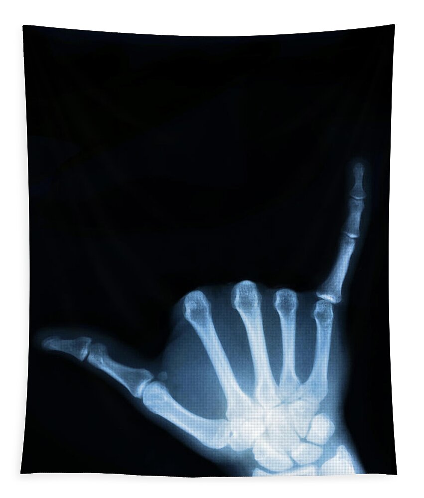 X-ray Tapestry featuring the photograph Hang Loose by Gravityx9 Designs