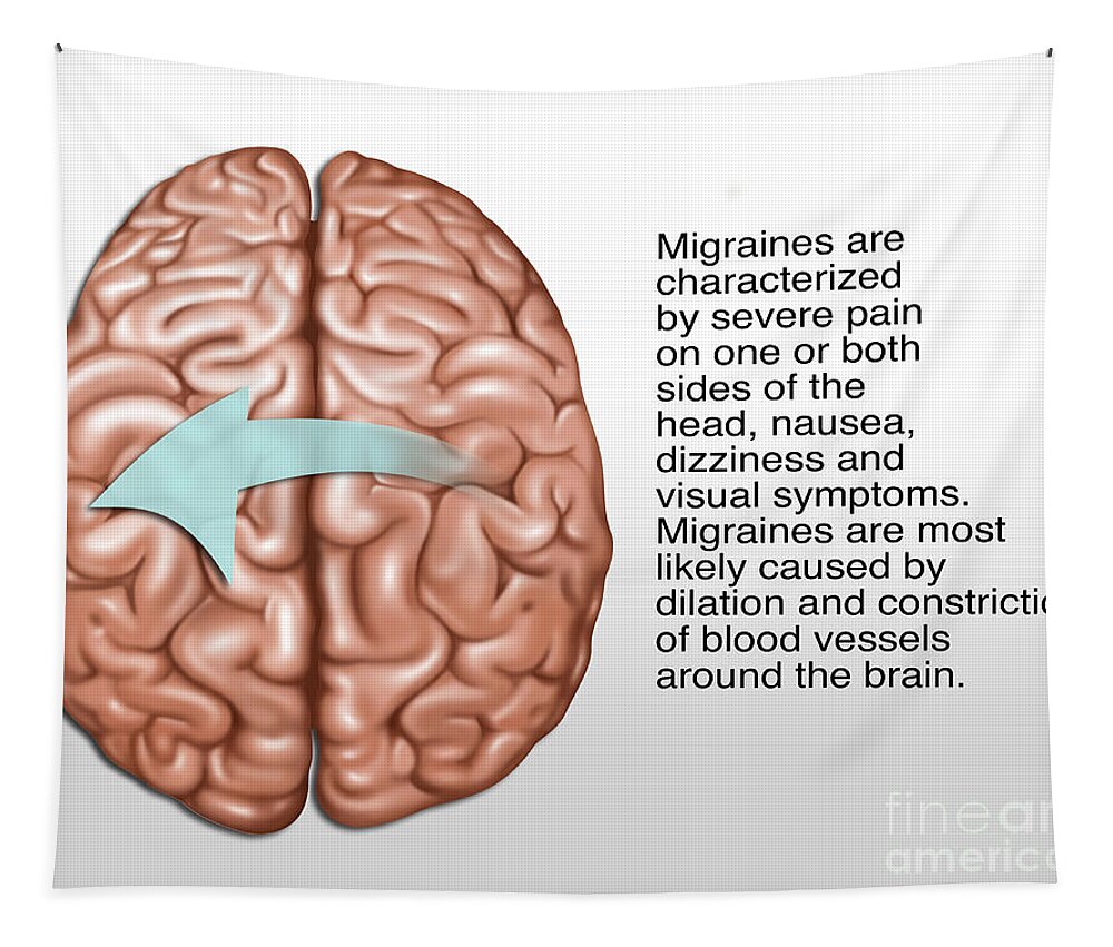 Artwork Tapestry featuring the photograph Migraine, Illustration by Gwen Shockey