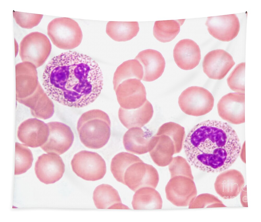 Neutrophil Polymorphs Tapestry featuring the photograph Neutrophils In Peripheral Blood Smear by M. I. Walker