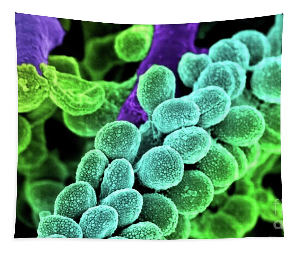 Streptococcus Bacteria Tapestry featuring the photograph Streptococcus Bacteria - Colored scanning electron micrograph. by Doc Braham