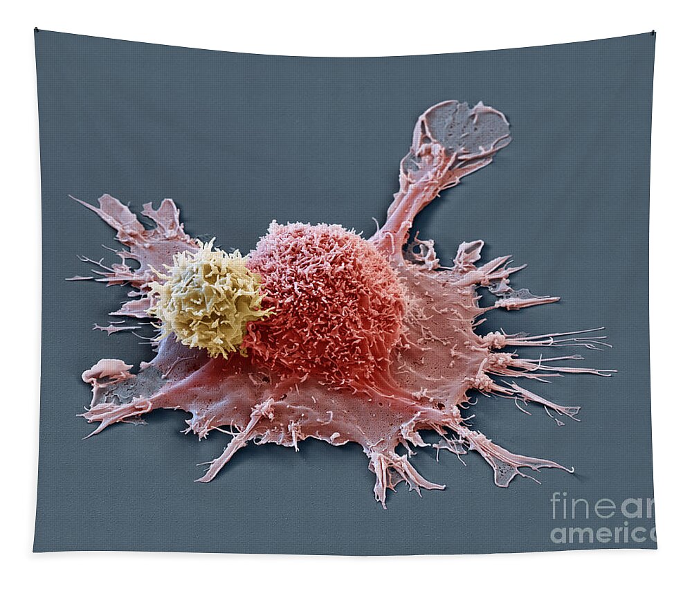 Adenocarcinoma Tapestry featuring the photograph SEM of chimera antigen receptor cell by Eye of Sceince