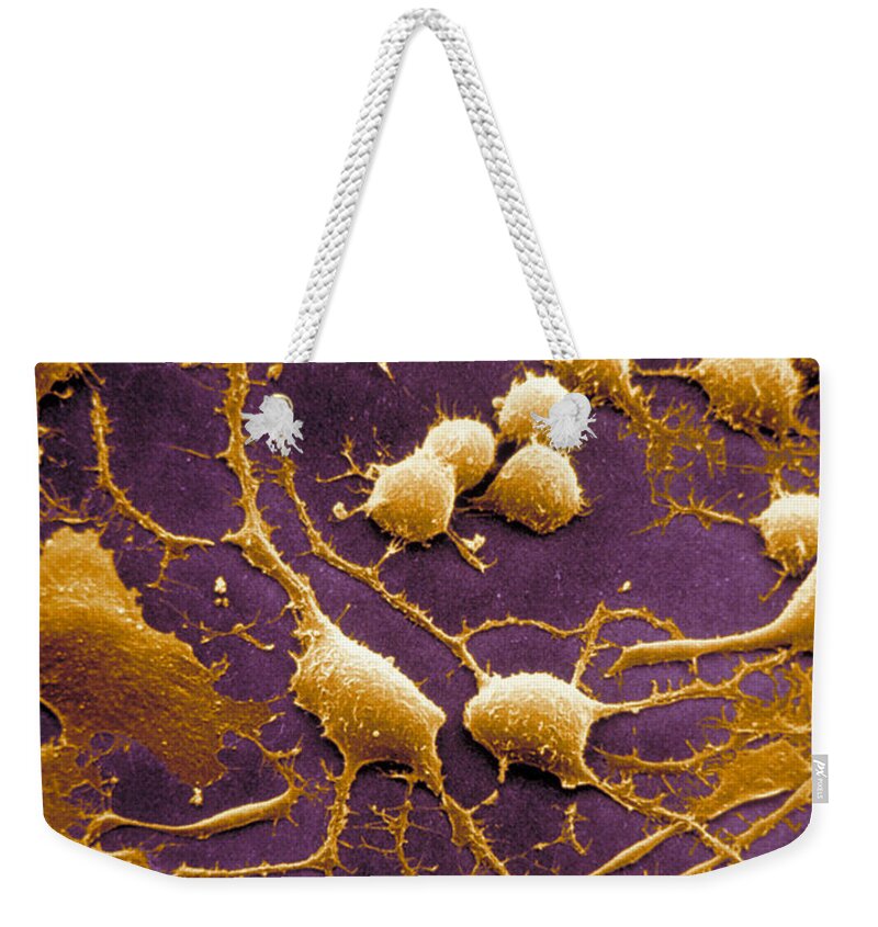 Nerve Tissue Weekender Tote Bag featuring the photograph Neurons #3 by David M Phillips
