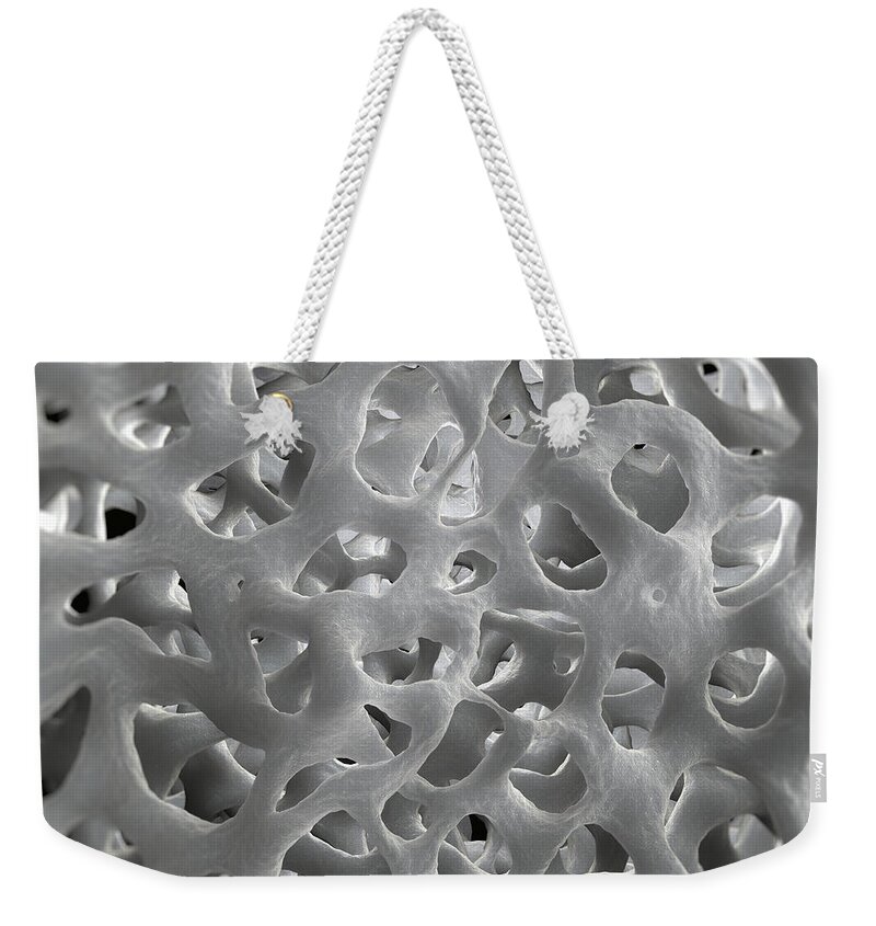 Bone Weekender Tote Bag featuring the photograph Cancellous Bone #2 by Science Picture Co