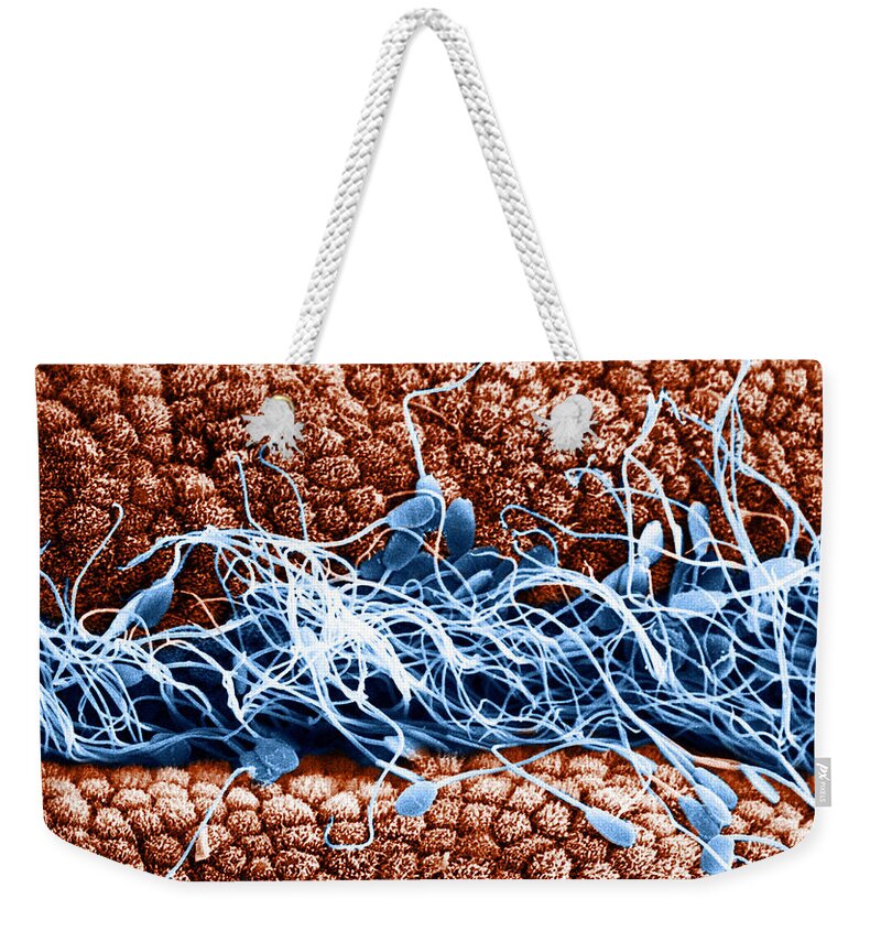 Scanning Electron Micrographs Weekender Tote Bag featuring the photograph Sperm On Oviduct Surface, Sem #2 by David M. Phillips