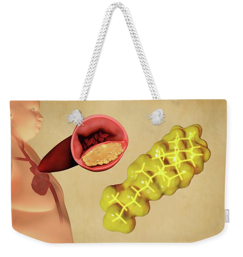 Art Weekender Tote Bag featuring the photograph Cholesterol And Atherosclerosis, Artwork by Juan Gaertner